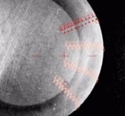 Povrchové prokalení